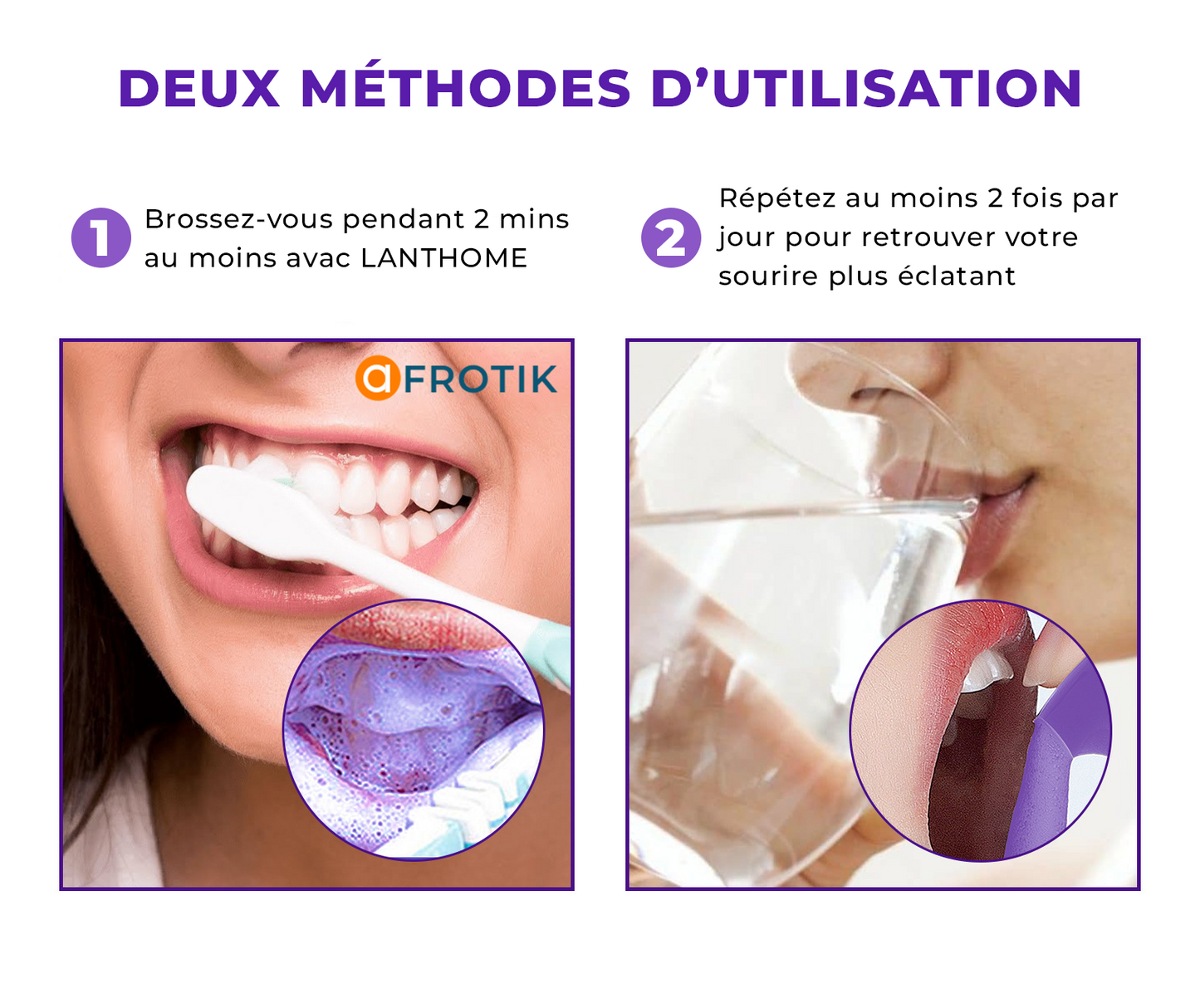 MOUSSE BLANCHISSSEUSE DES DENTS LANTHOME V34 : LE SECRET POUR RETROUVER SON SOURIRE ECLATANT