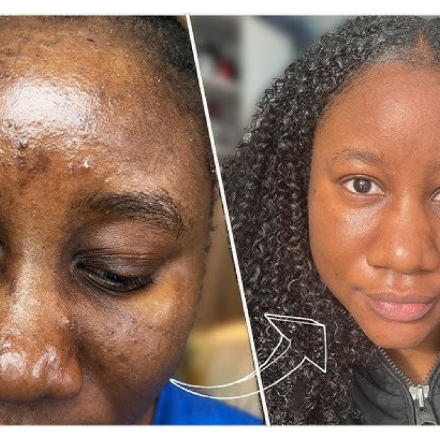 Crème réparatrice des imperfections